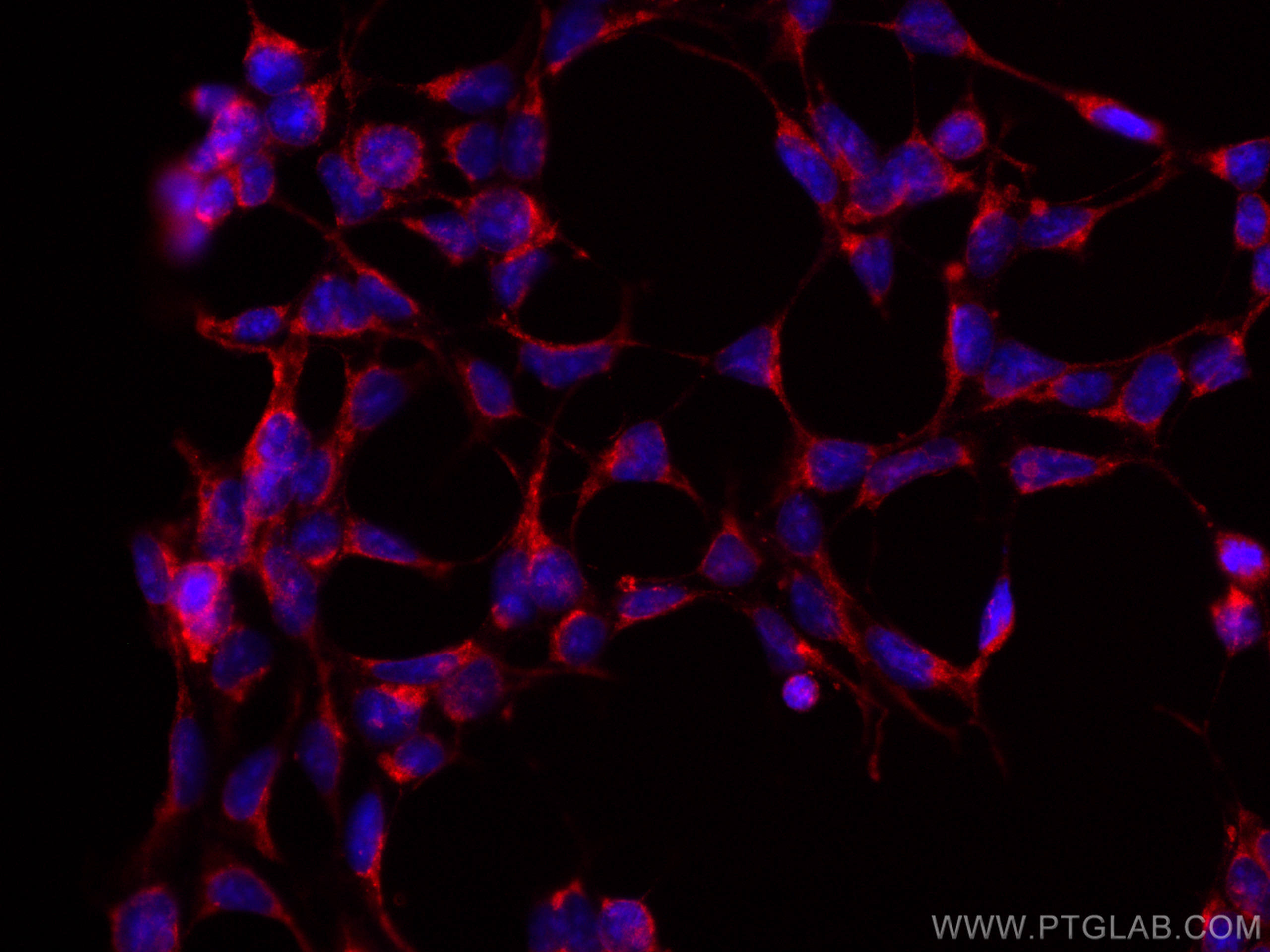 Immunofluorescence (IF) / fluorescent staining of HEK-293 cells using CoraLite®594-conjugated RAB3GAP1 Monoclonal antibo (CL594-66688)