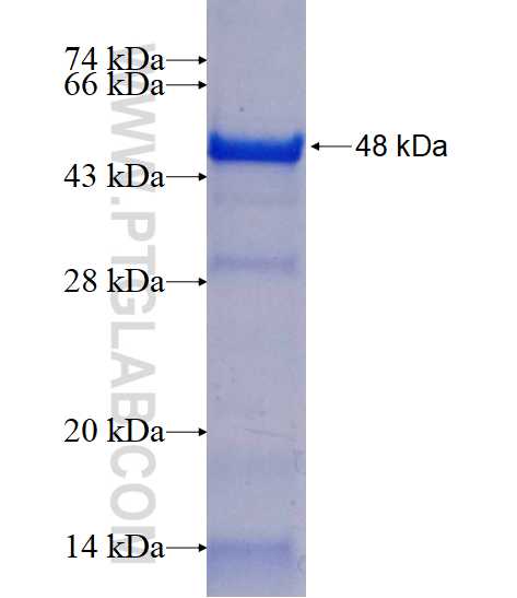 RAB3GAP1 fusion protein Ag17710 SDS-PAGE