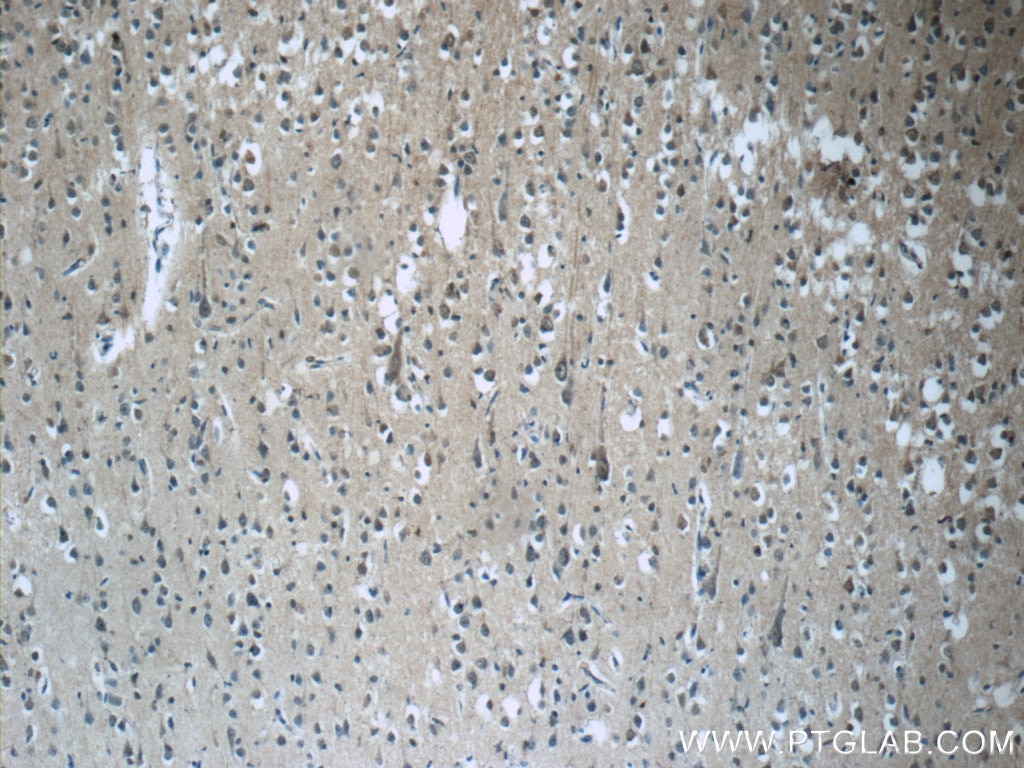Immunohistochemistry (IHC) staining of human brain tissue using RAB3GAP2 Polyclonal antibody (24599-1-AP)
