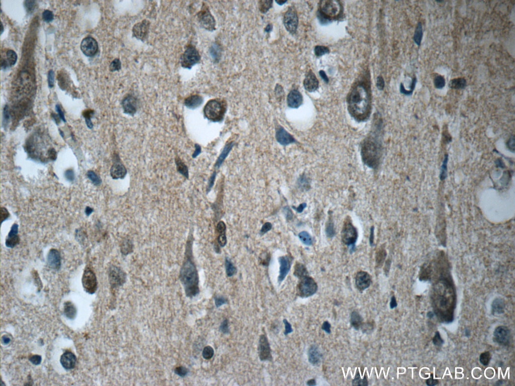 Immunohistochemistry (IHC) staining of human brain tissue using RAB3GAP2 Polyclonal antibody (24599-1-AP)