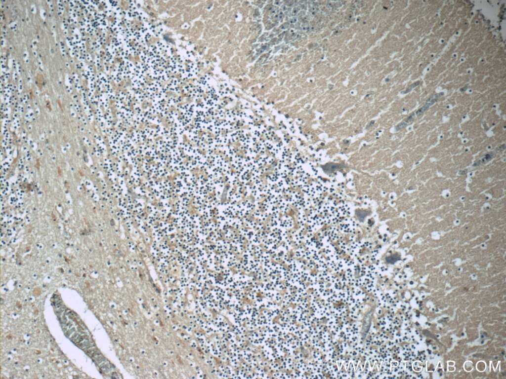 Immunohistochemistry (IHC) staining of human cerebellum tissue using RAB3GAP2 Polyclonal antibody (24599-1-AP)