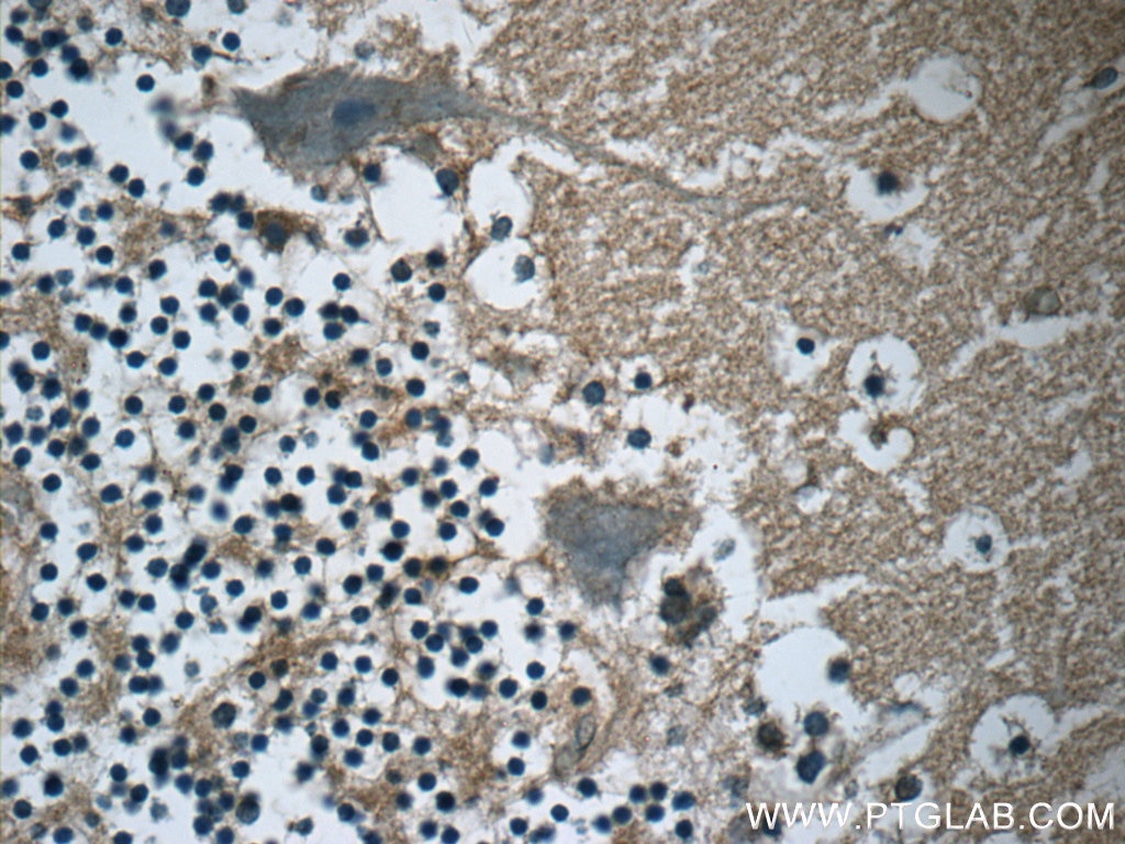Immunohistochemistry (IHC) staining of human cerebellum tissue using RAB3GAP2 Polyclonal antibody (24599-1-AP)