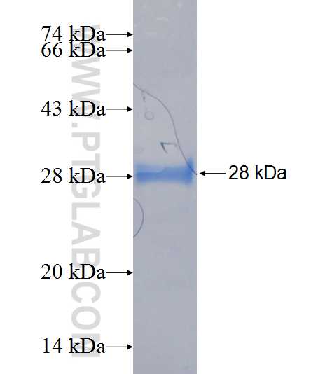 RAB3GAP2 fusion protein Ag20254 SDS-PAGE
