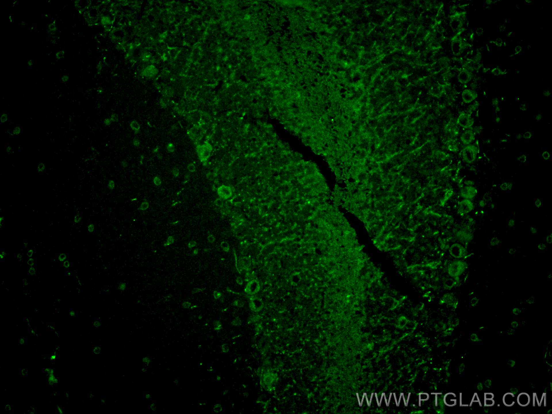 Immunofluorescence (IF) / fluorescent staining of mouse cerebellum tissue using RAB3IL1 Polyclonal antibody (17827-1-AP)