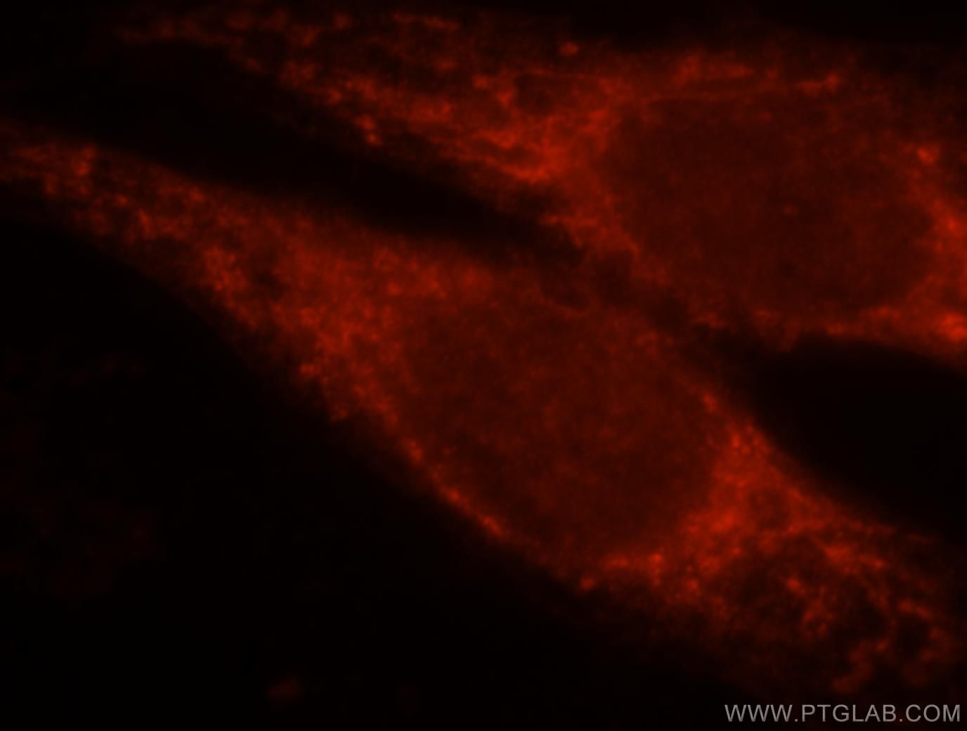 Immunofluorescence (IF) / fluorescent staining of HeLa cells using RAB3IL1 Polyclonal antibody (17827-1-AP)