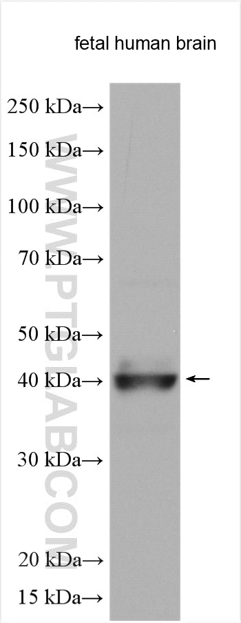 Western Blot (WB) analysis of various lysates using RAB3IL1 Polyclonal antibody (17827-1-AP)