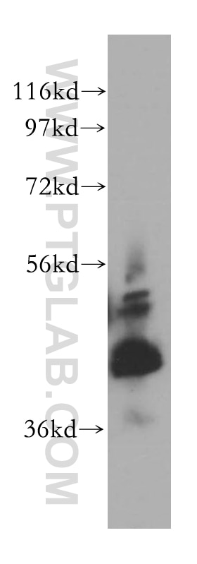 Western Blot (WB) analysis of human testis tissue using RAB3IL1 Polyclonal antibody (17827-1-AP)