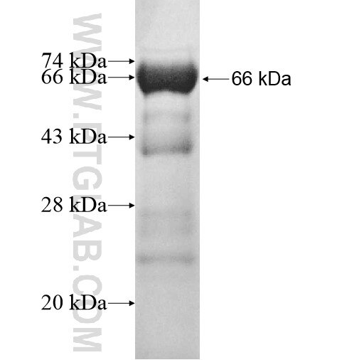 RAB3IL1 fusion protein Ag12204 SDS-PAGE