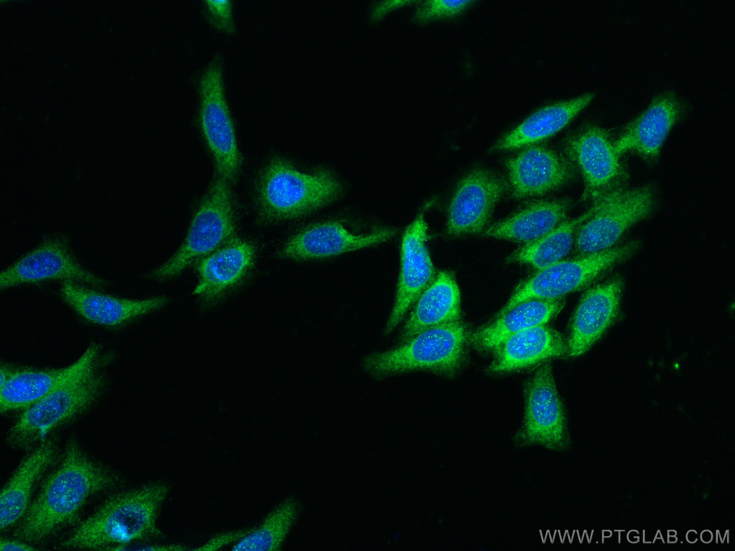 Immunofluorescence (IF) / fluorescent staining of HepG2 cells using RAB3IP Polyclonal antibody (12321-1-AP)