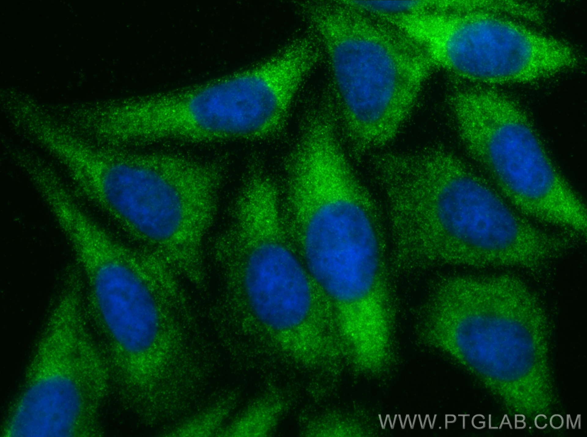 Immunofluorescence (IF) / fluorescent staining of HepG2 cells using RAB3IP/Rabin8 Polyclonal antibody (12321-1-AP)