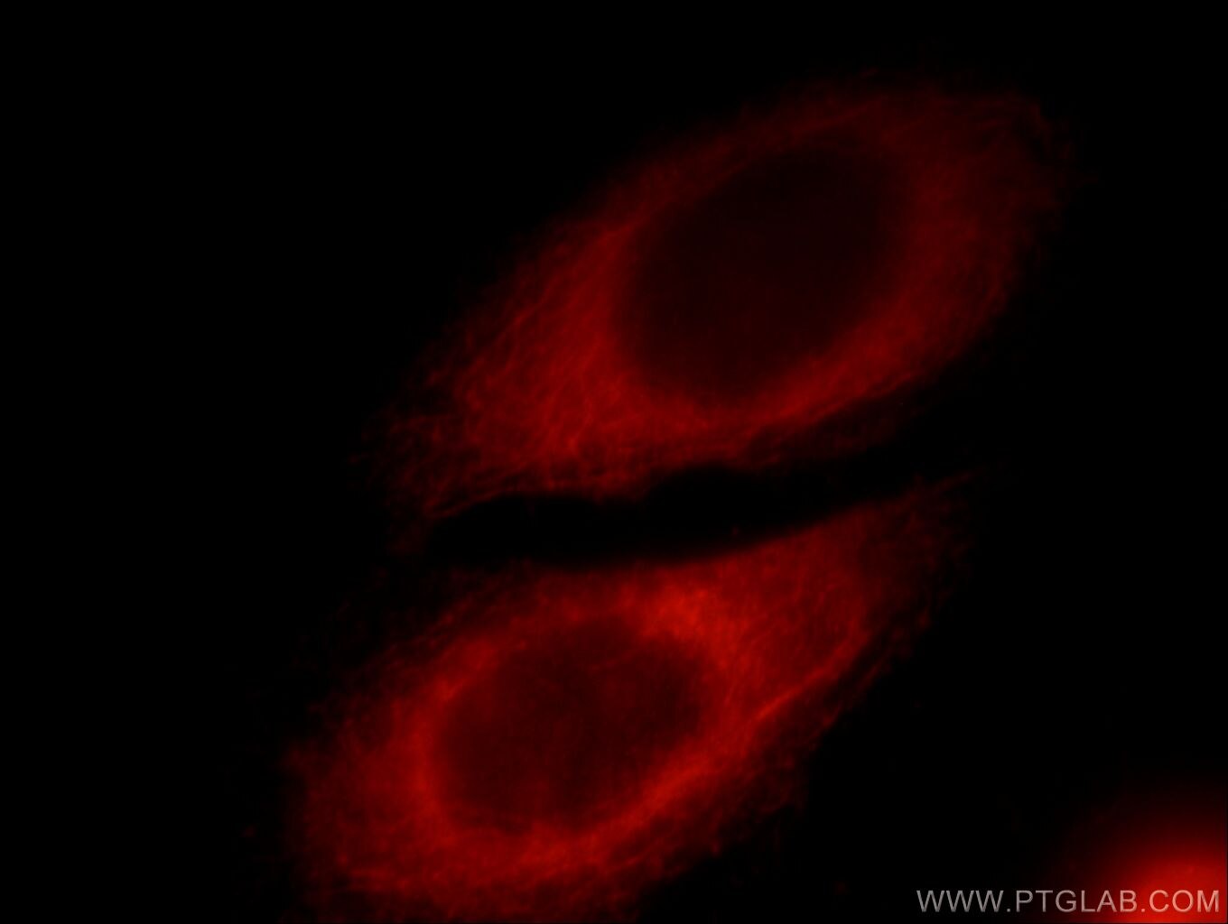 RAB3IP Polyclonal antibody