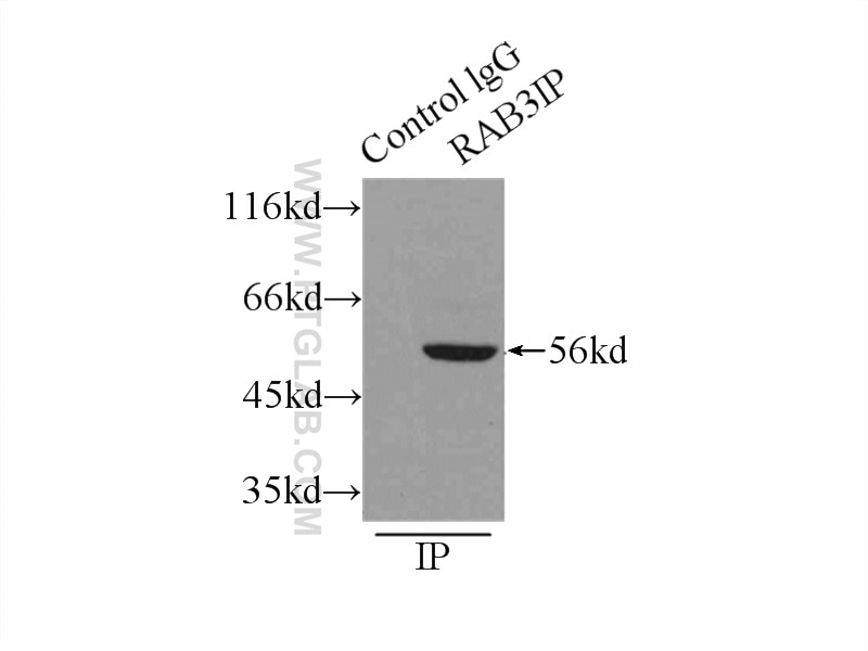 Immunoprecipitation (IP) experiment of mouse lung tissue using RAB3IP Polyclonal antibody (12321-1-AP)