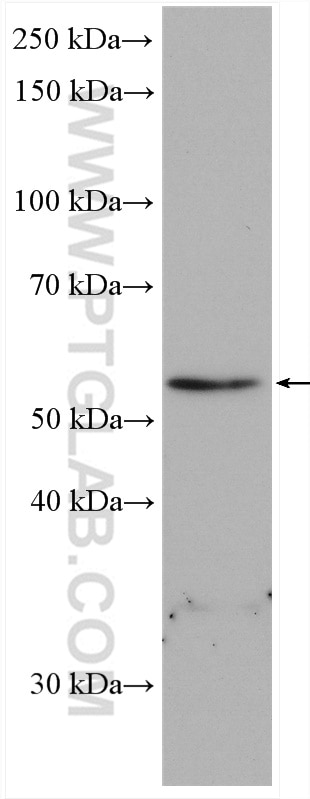 Western Blot (WB) analysis of mouse heart tissue using RAB3IP Polyclonal antibody (12321-1-AP)