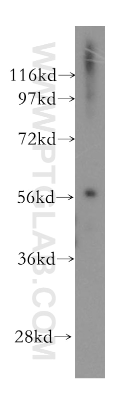 Western Blot (WB) analysis of human heart tissue using RAB3IP Polyclonal antibody (12321-1-AP)