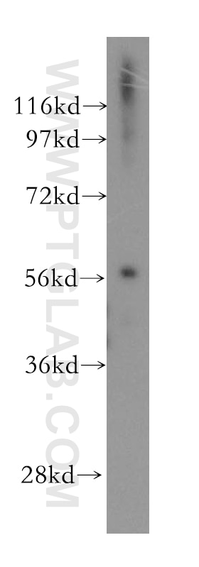 WB analysis of human heart using 12321-1-AP