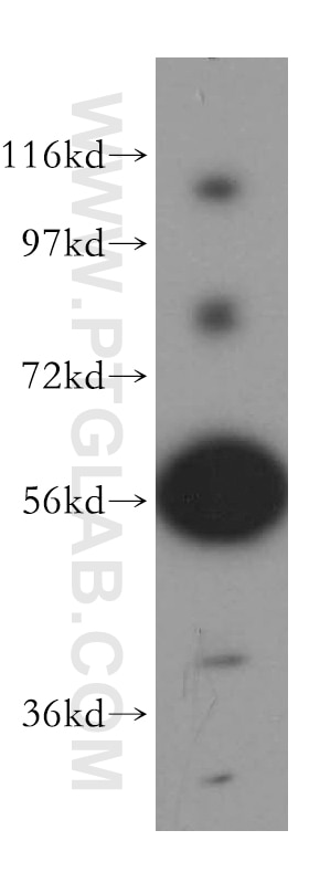 Western Blot (WB) analysis of mouse lung tissue using RAB3IP Polyclonal antibody (12321-1-AP)