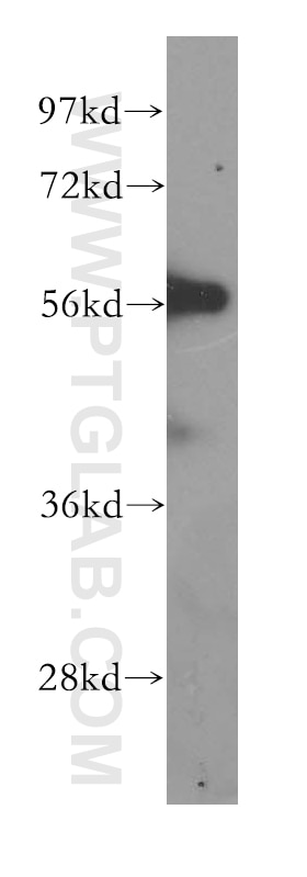 Western Blot (WB) analysis of human brain tissue using RAB3IP Polyclonal antibody (12321-1-AP)