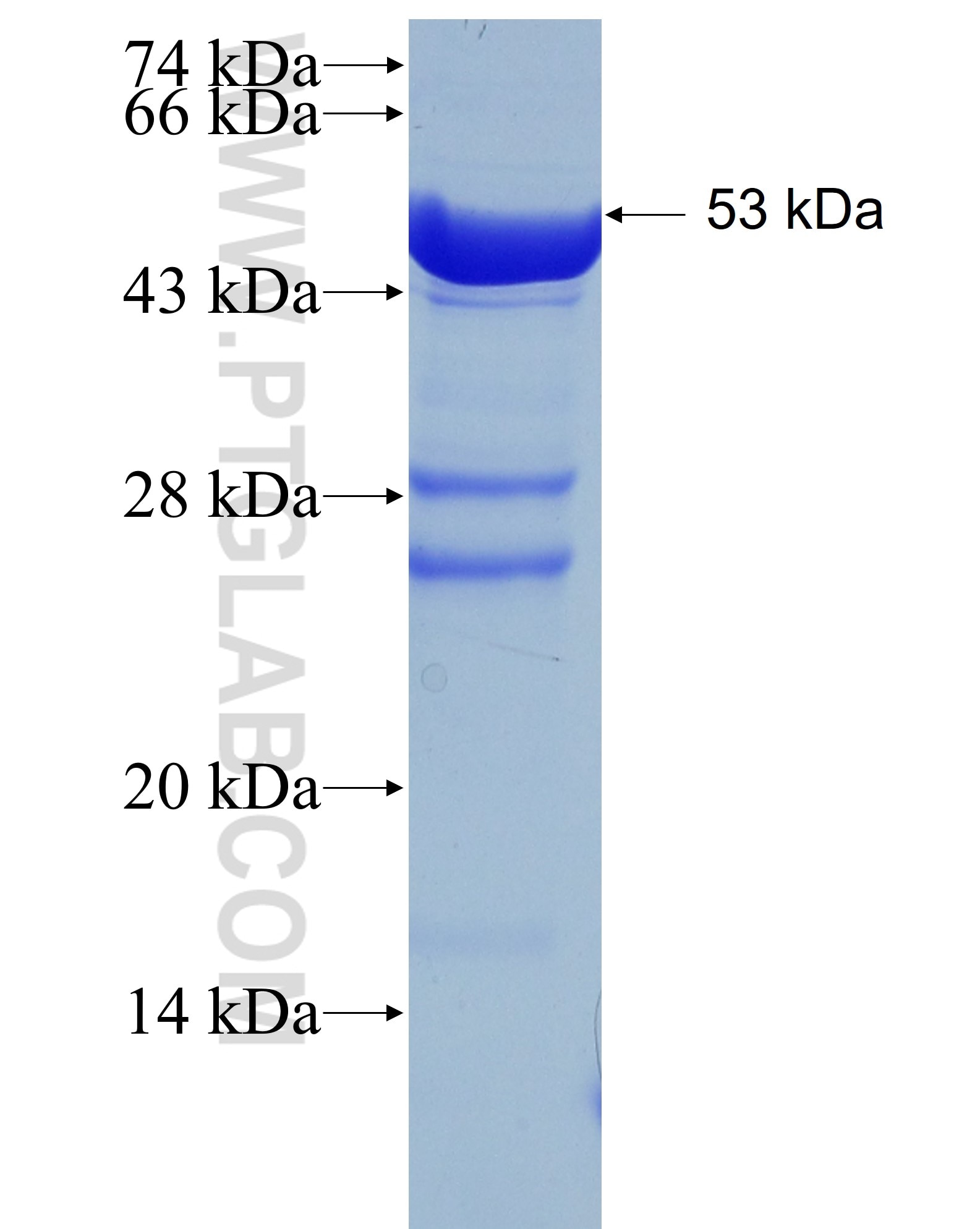 RABIN8 fusion protein Ag2974 SDS-PAGE