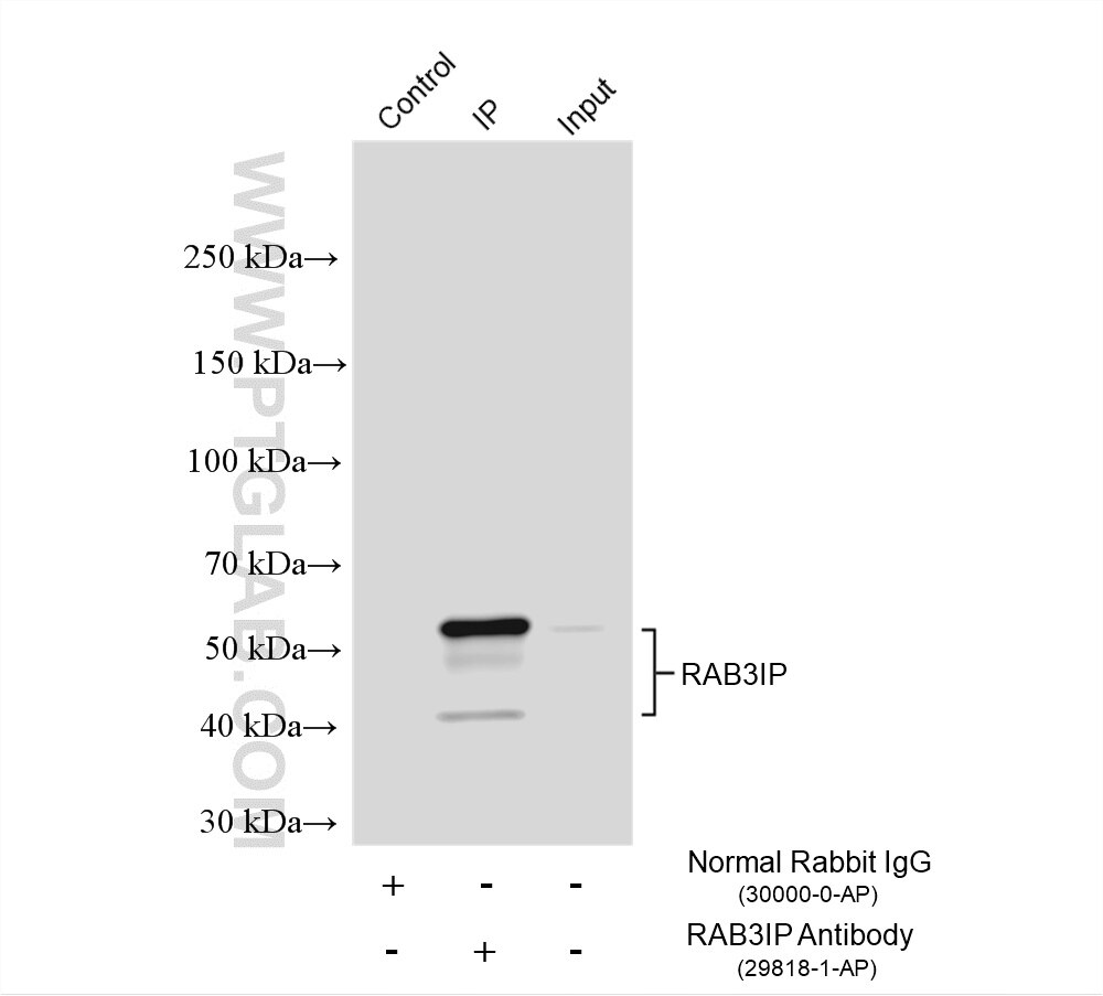 IP result of anti-RAB3IP/Rabin8 (IP:29818-1-AP, 4ug; Detection:29818-1-AP 1:1000) with HEK-293 cells lysate 1640 ug. Immunoprecipitation (IP) experiment of HEK-293 cells using RAB3IP/Rabin8 Polyclonal antibody (29818-1-AP)