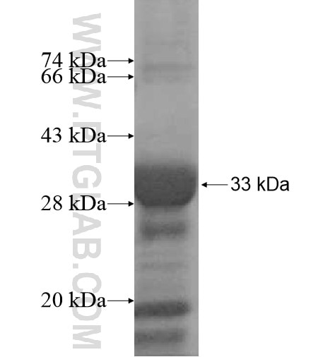 RAB40A fusion protein Ag12469 SDS-PAGE