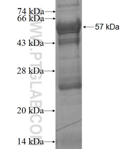 RAB40B fusion protein Ag3155 SDS-PAGE