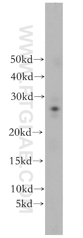 Western Blot (WB) analysis of human kidney tissue using RAB41 Polyclonal antibody (18818-1-AP)