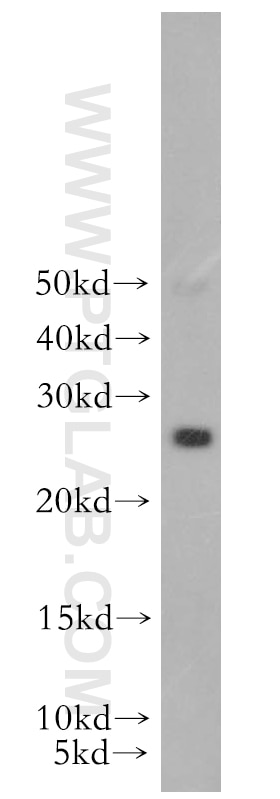 Western Blot (WB) analysis of PC-3 cells using RAB41 Polyclonal antibody (18818-1-AP)