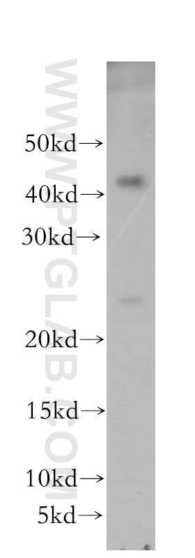 Western Blot (WB) analysis of mouse small intestine tissue using RAB41 Polyclonal antibody (18818-1-AP)