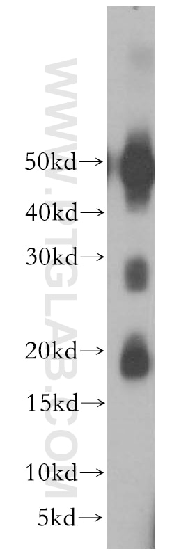 Western Blot (WB) analysis of human brain tissue using RAB41 Polyclonal antibody (18818-1-AP)