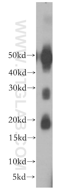 WB analysis of human brain using 18818-1-AP
