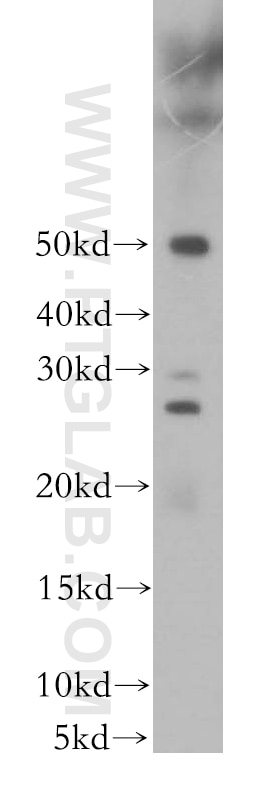 Western Blot (WB) analysis of mouse uterus tissue using RAB41 Polyclonal antibody (18818-1-AP)