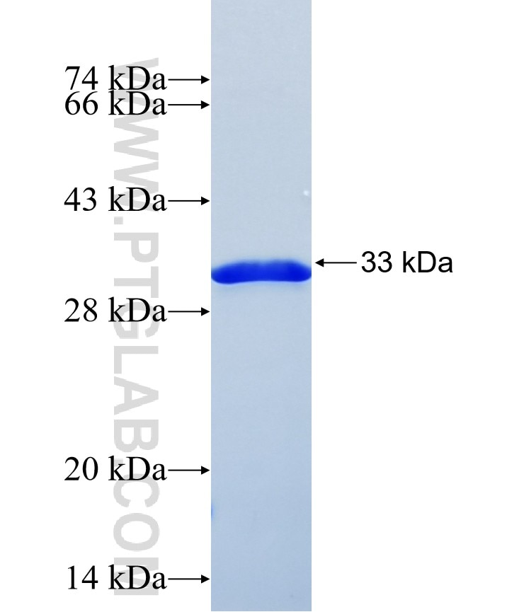 RAB41 fusion protein Ag37990 SDS-PAGE RAB41 fusion protein Ag37990 SDS-PAGE