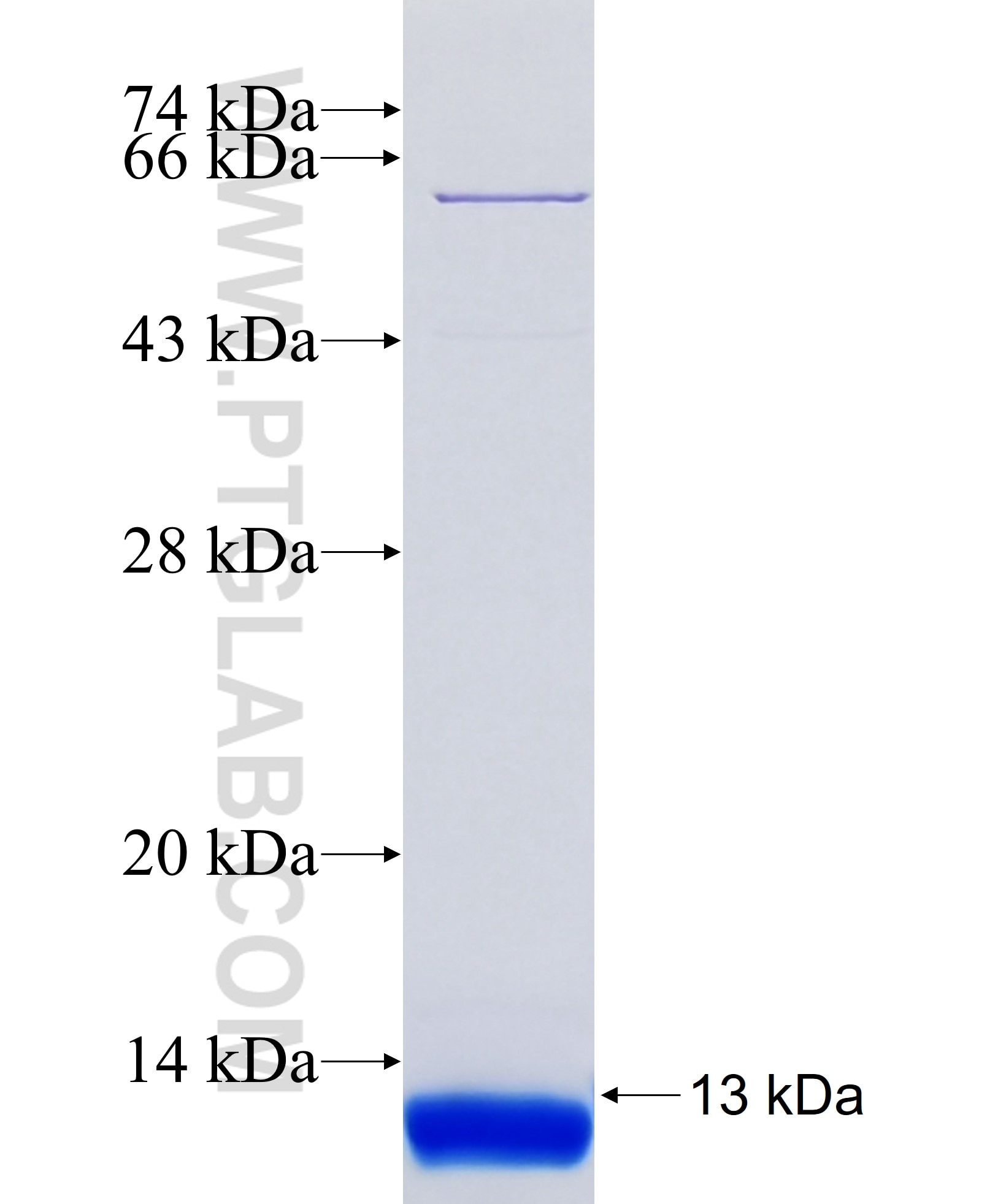 RAB41 fusion protein Ag38001 SDS-PAGE RAB41 fusion protein Ag38001 SDS-PAGE