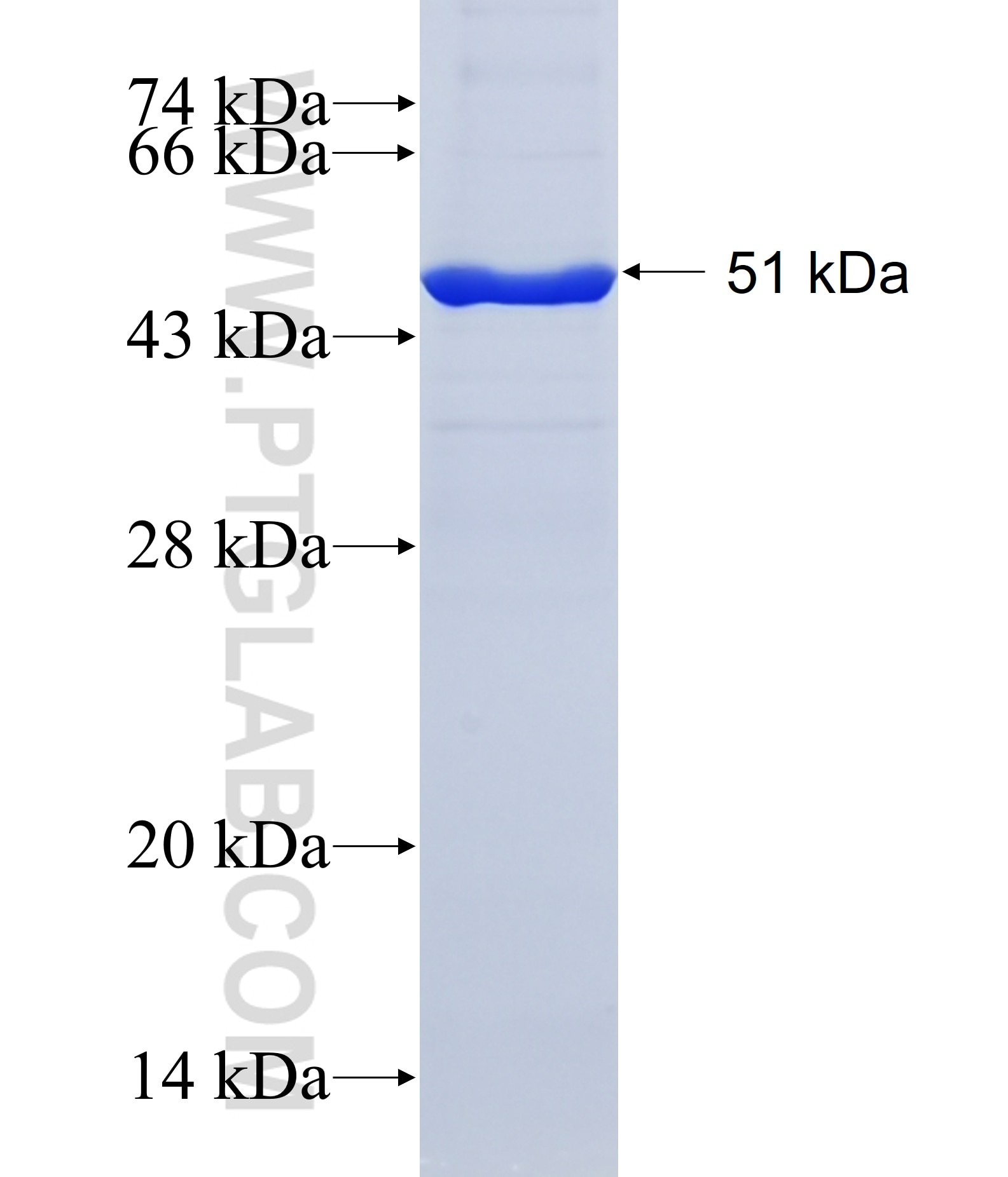 RAB42 fusion protein Ag38592 SDS-PAGE RAB42 fusion protein Ag38592 SDS-PAGE
