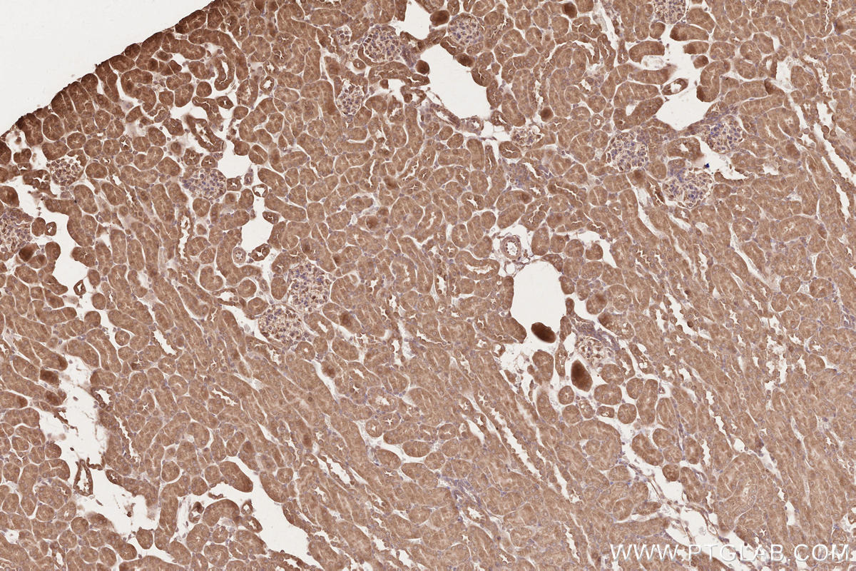 Immunohistochemistry (IHC) staining of mouse kidney tissue using RAB43 Polyclonal antibody (28240-1-AP)