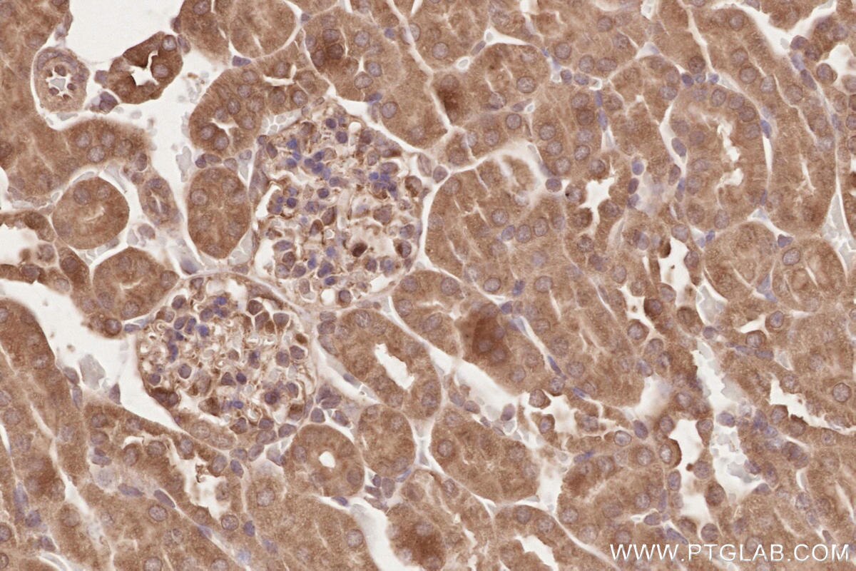 Immunohistochemistry (IHC) staining of mouse kidney tissue using RAB43 Polyclonal antibody (28240-1-AP)