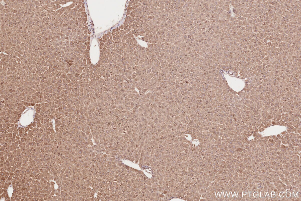 Immunohistochemistry (IHC) staining of mouse liver tissue using RAB43 Polyclonal antibody (28240-1-AP)