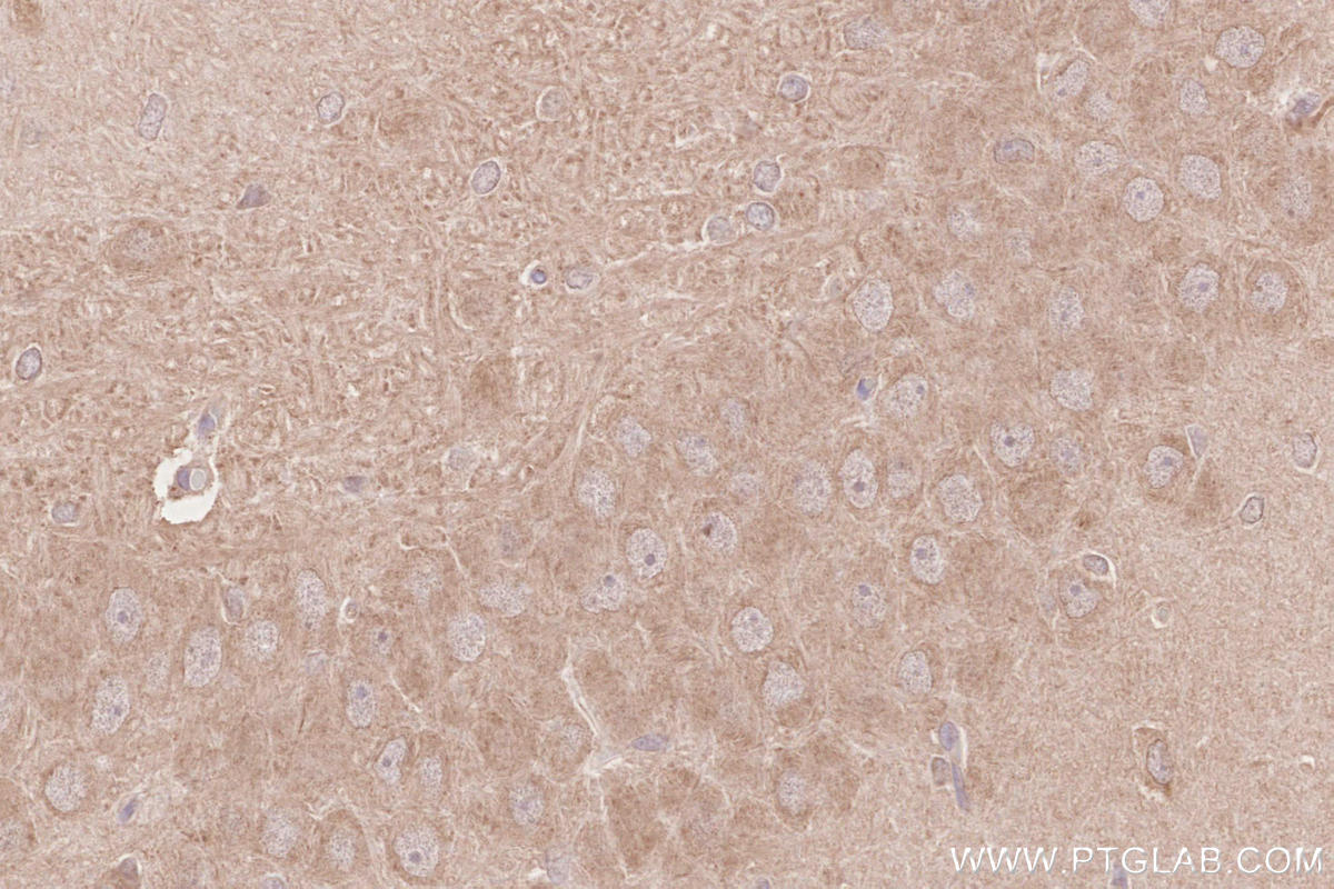 Immunohistochemistry (IHC) staining of rat brain tissue using RAB43 Polyclonal antibody (28240-1-AP)