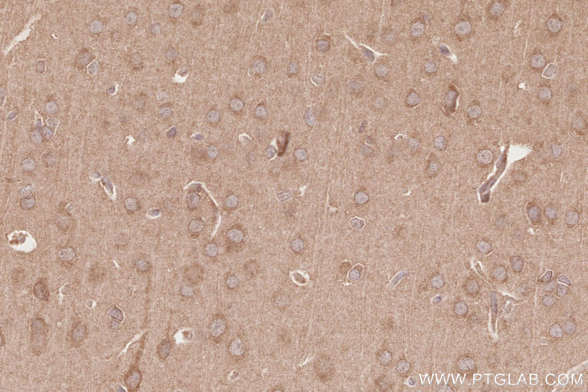 Immunohistochemistry (IHC) staining of rat brain tissue using RAB43 Polyclonal antibody (28240-1-AP)