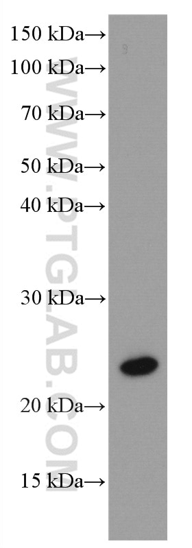 Western Blot (WB) analysis of human brain tissue using RAB43 Monoclonal antibody (66654-1-Ig)