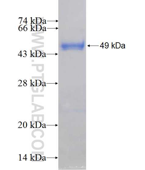 RAB43 fusion protein Ag10277 SDS-PAGE