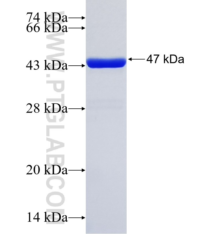 RAB44 fusion protein Ag35126 SDS-PAGE RAB44 fusion protein Ag35126 SDS-PAGE