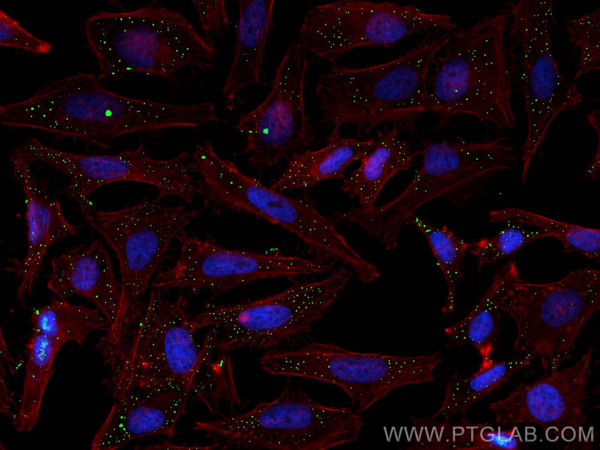 Immunofluorescence (IF) / fluorescent staining of HeLa cells using RAB4A Polyclonal antibody (10347-1-AP)