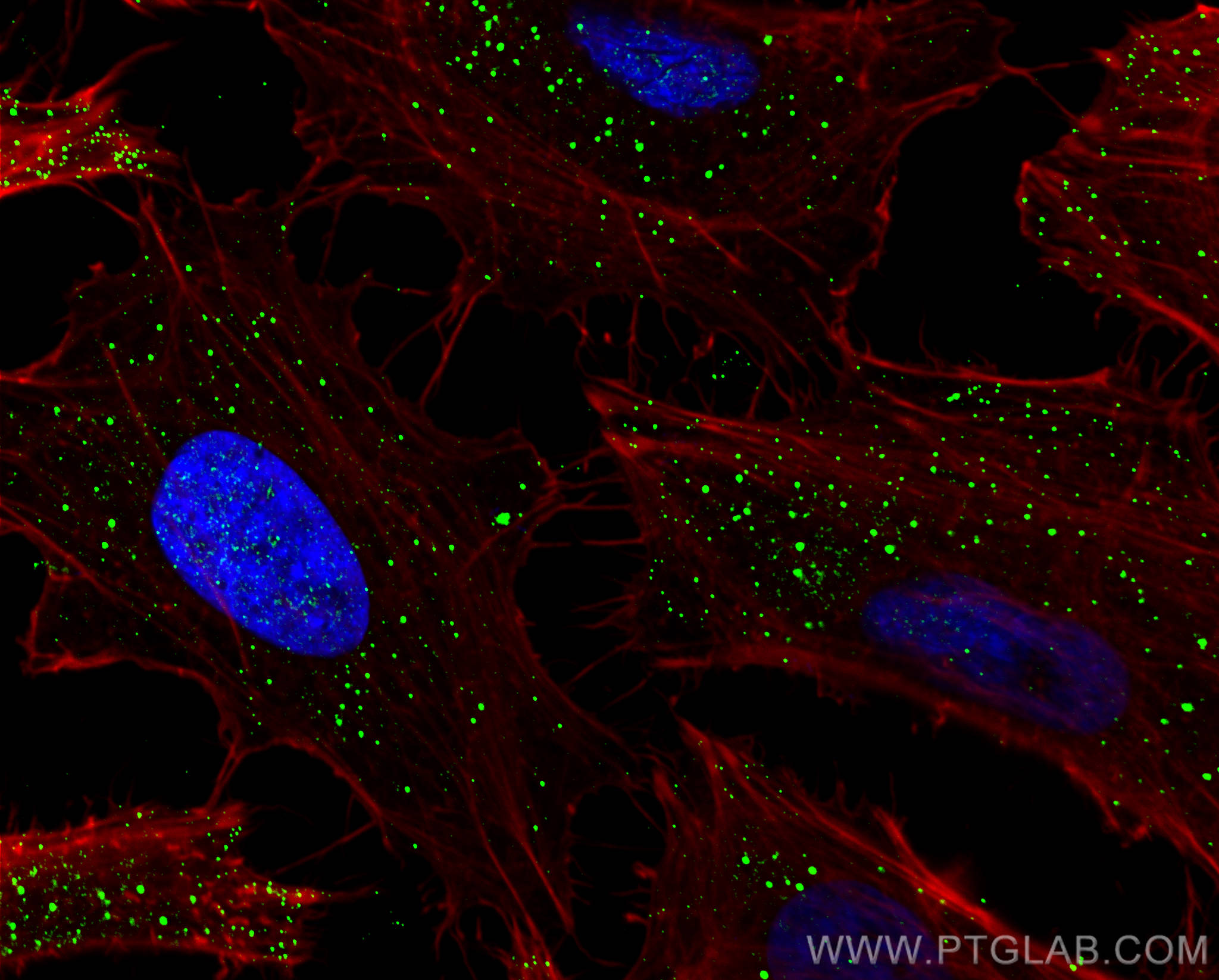 Immunofluorescence (IF) / fluorescent staining of HeLa cells using RAB4A Polyclonal antibody (10347-1-AP)