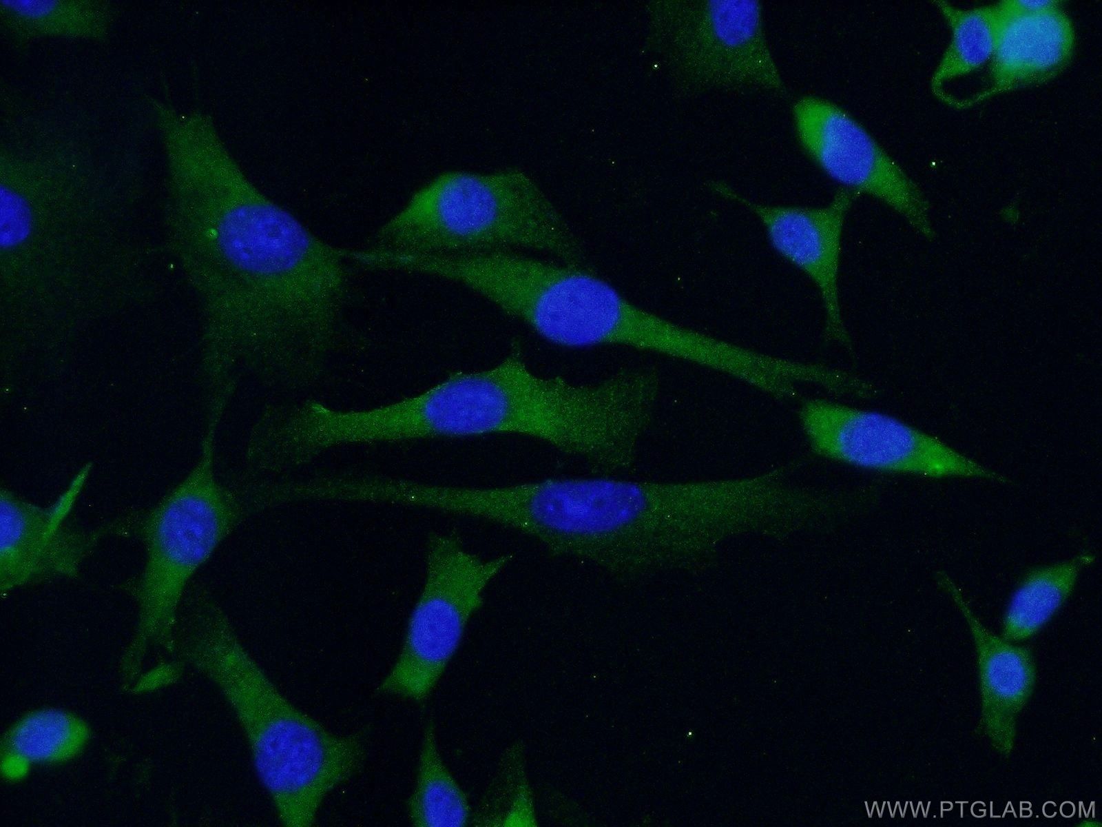 Immunofluorescence (IF) / fluorescent staining of NIH/3T3 cells using RAB4A Polyclonal antibody (10347-1-AP)