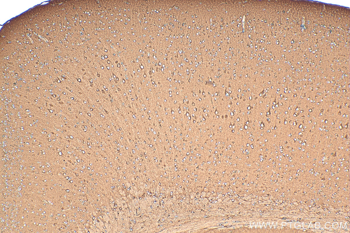 Immunohistochemistry (IHC) staining of mouse brain tissue using RAB4A Polyclonal antibody (10347-1-AP)