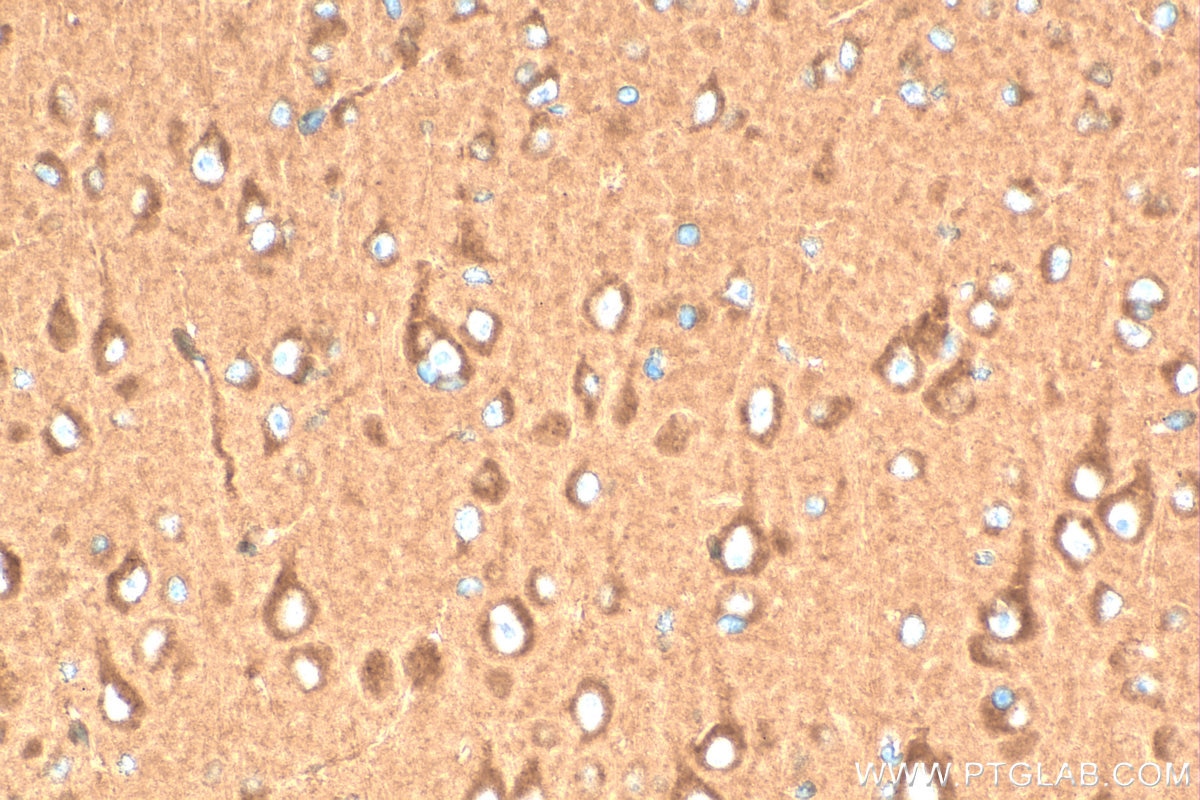 Immunohistochemistry (IHC) staining of mouse brain tissue using RAB4A Polyclonal antibody (10347-1-AP)