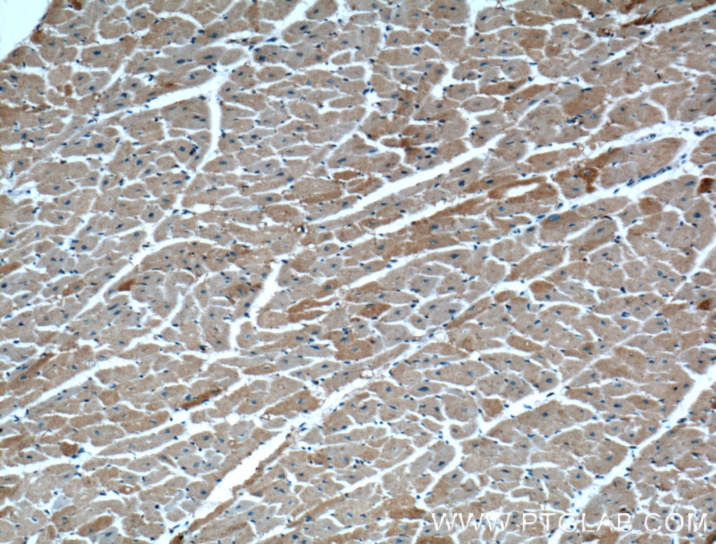 Immunohistochemistry (IHC) staining of human heart tissue using RAB4A Polyclonal antibody (10347-1-AP)