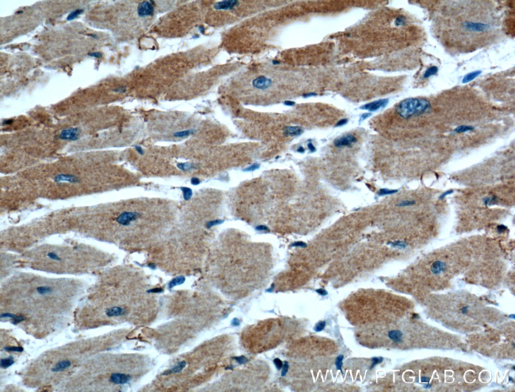 Immunohistochemistry (IHC) staining of human heart tissue using RAB4A Polyclonal antibody (10347-1-AP)