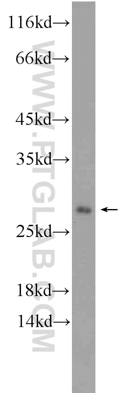 Western Blot (WB) analysis of rat brain tissue using RAB4A Polyclonal antibody (10347-1-AP)